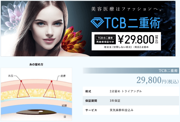 TCB東京中央美容外科の二重埋没整形