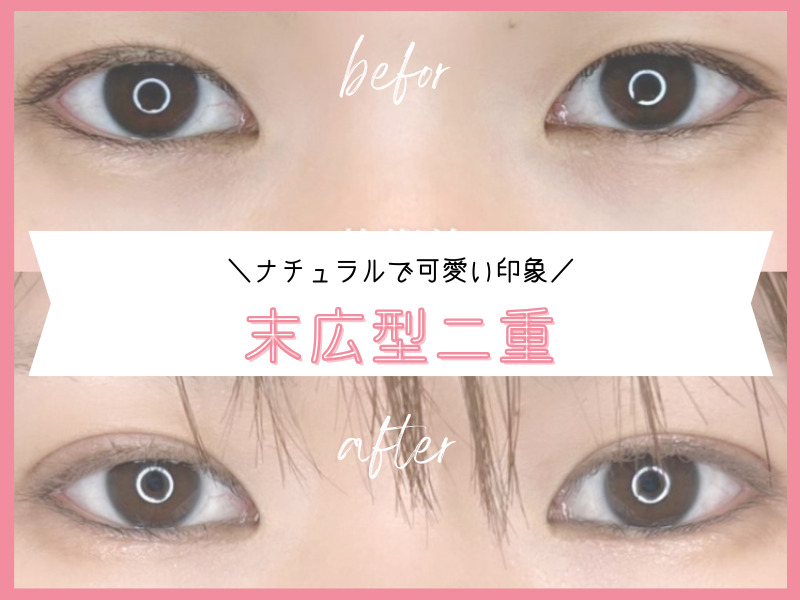 末広型：ナチュラルな仕上がり