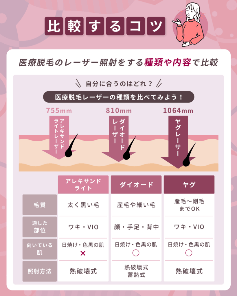 医療脱毛のレーザー照射をする種類や内容